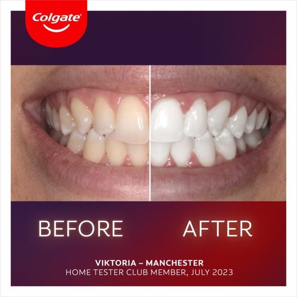 Colgate Max White Ultimate At Home LED Teeth Whitening Kit