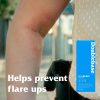 Double Base Flare Relief